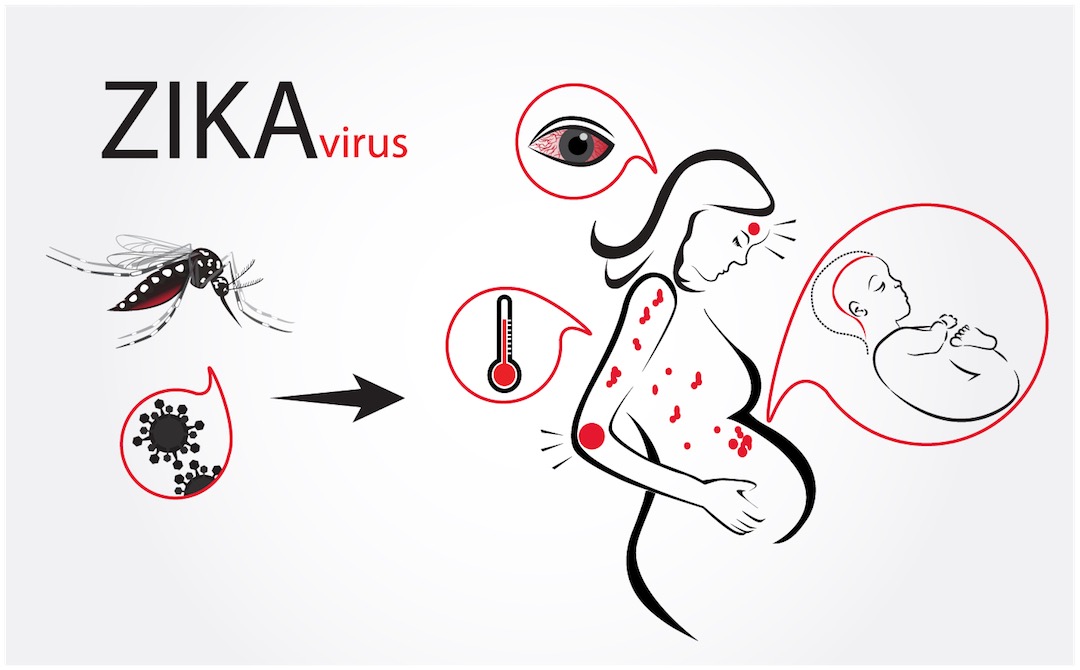 Zika Virüsü - Elika Hamile - Hamilelik ve Gebelik Takibi